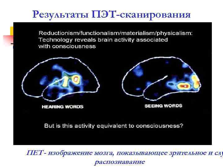 Результаты ПЭТ-сканирования ПET - изображение мозга, показывающее зрительное и слу распознавание 