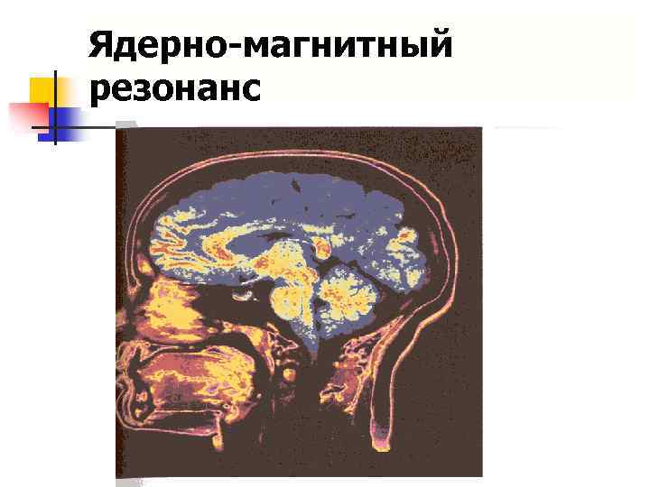 Ядерно-магнитный резонанс 