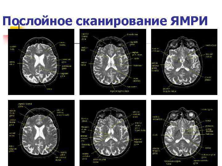 Послойное сканирование ЯМРИ 