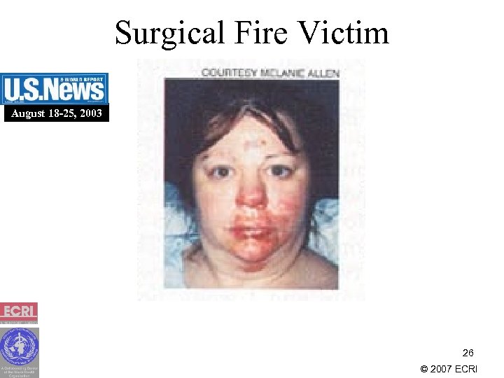 Surgical Fire Victim August 18 -25, 2003 26 © 2007 ECRI 