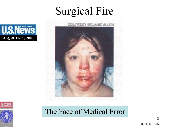 Surgical Fire August 18 -25, 2003 The Face of Medical Error 3 © 2007
