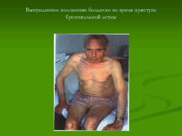 Вынужденное положение больного во время приступа бронхиальной астмы 