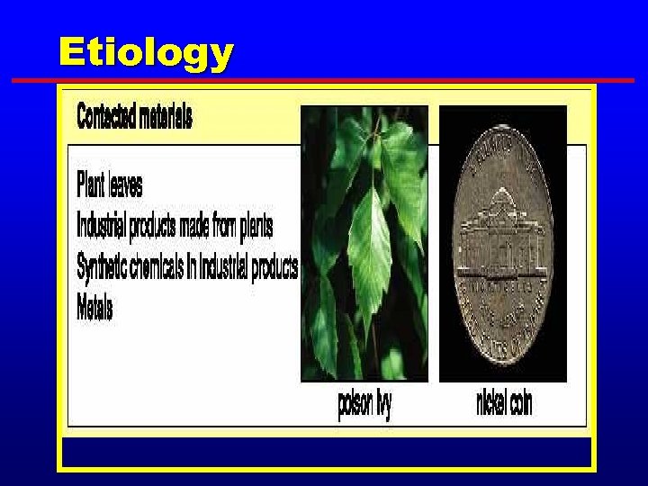 Etiology 