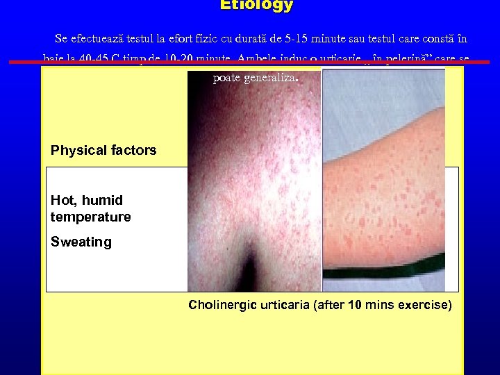 Etiology Se efectuează testul la efort fizic cu durată de 5 -15 minute sau