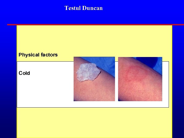 Testul Duncan Physical factors Cold 
