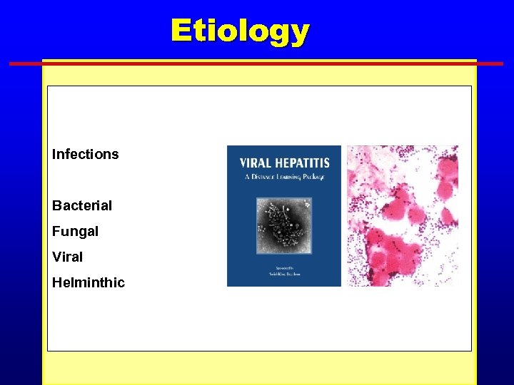 Etiology Infections Bacterial Fungal Viral Helminthic 