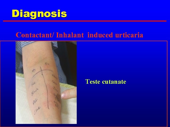 Diagnosis Contactant/ Inhalant induced urticaria Teste cutanate 
