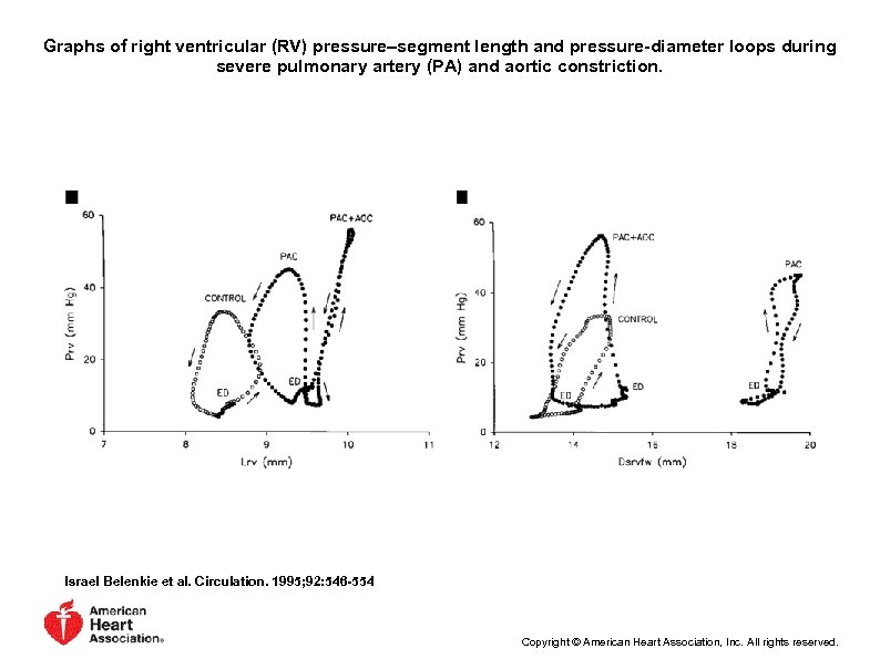 Graphs of right ventricular (RV) pressure–segment length and pressure-diameter loops during severe pulmonary artery
