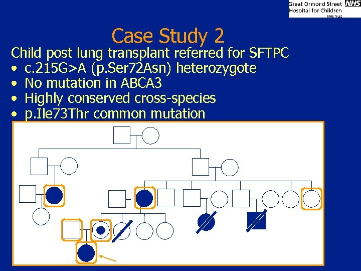 Case Study 2 Child post lung transplant referred for SFTPC • c. 215 G>A