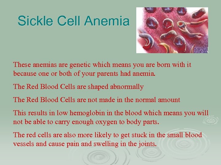 Sickle Cell Anemia These anemias are genetic which means you are born with it