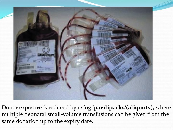 Donor exposure is reduced by using 'paedipacks‘(aliquots), where multiple neonatal small-volume transfusions can be