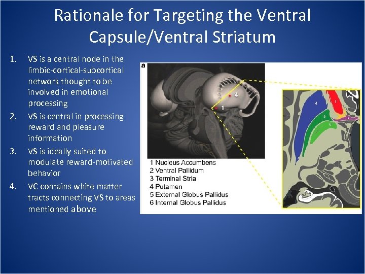 Rationale for Targeting the Ventral Capsule/Ventral Striatum 1. 2. 3. 4. VS is a