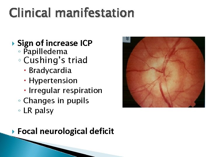 Clinical manifestation Sign of increase ICP ◦ Papilledema ◦ Cushing’s triad Bradycardia Hypertension Irregular