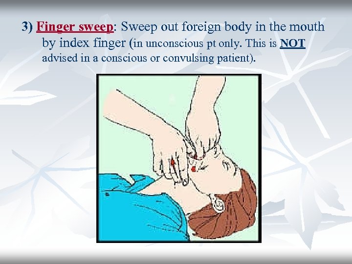 3) Finger sweep: Sweep out foreign body in the mouth by index finger (in