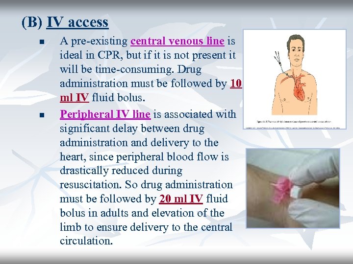 (B) IV access n n A pre-existing central venous line is ideal in CPR,
