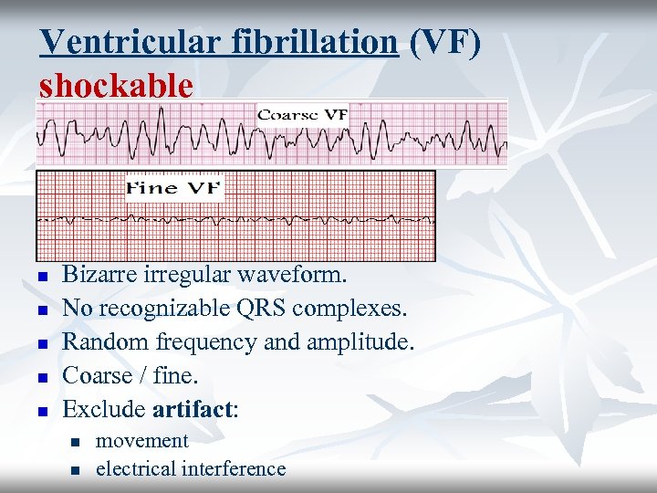 Ventricular fibrillation (VF) shockable n n n Bizarre irregular waveform. No recognizable QRS complexes.