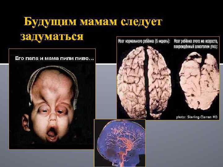 Будущим мамам следует задуматься 