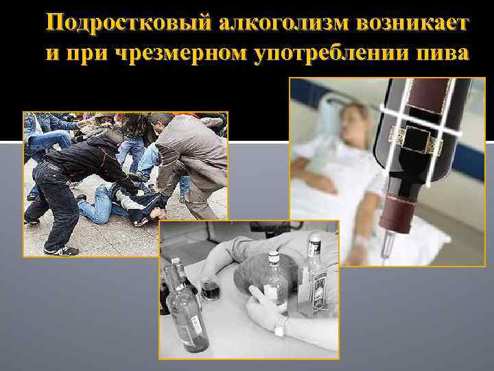 Подростковый алкоголизм возникает и при чрезмерном употреблении пива 