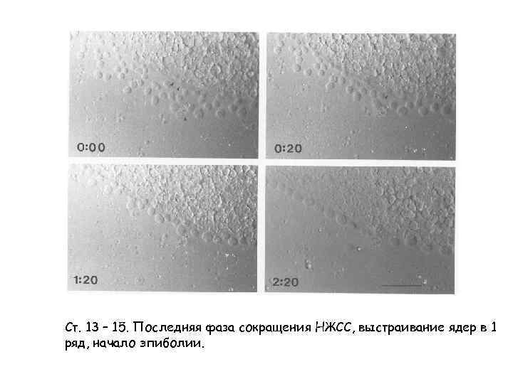 Ст. 13 – 15. Последняя фаза сокращения НЖСС, выстраивание ядер в 1 ряд, начало