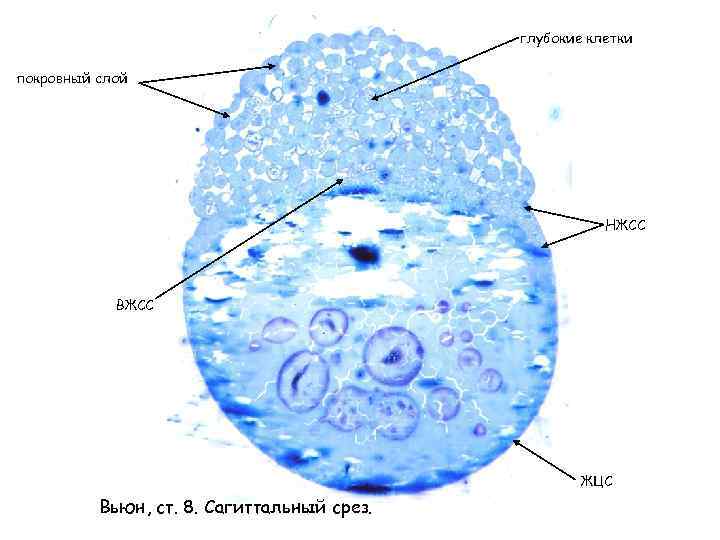 глубокие клетки покровный слой НЖСС ВЖСС ЖЦС Вьюн, ст. 8. Сагиттальный срез. 