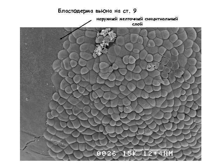 Бластодерма вьюна на ст. 9 наружный желточный синцитиальный слой 