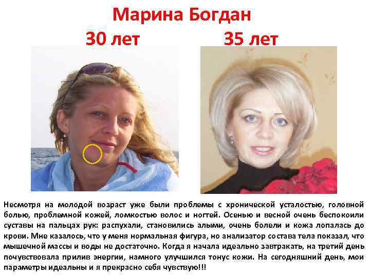 Марина Богдан 30 лет 35 лет Несмотря на молодой возраст уже были проблемы с