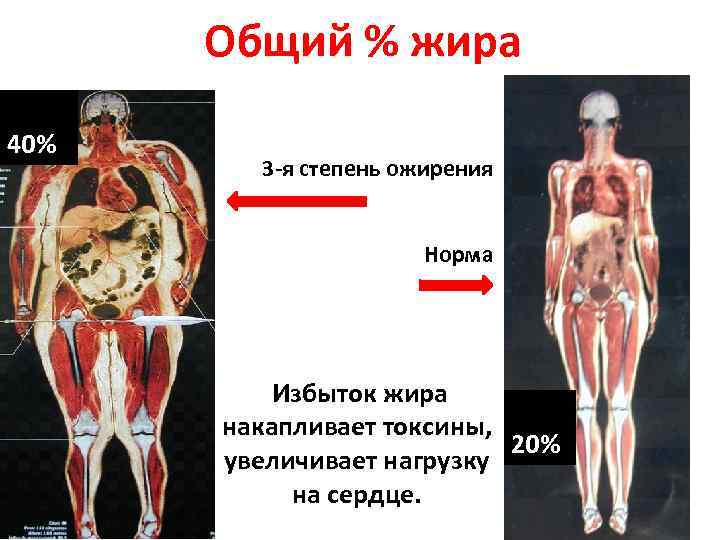 Жиру корни. Жировая ткань при ожирении. Состав человеческого жира.