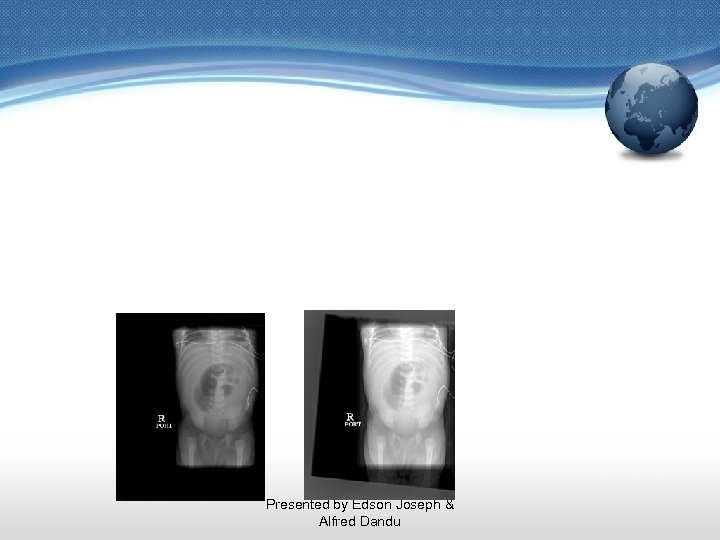 Presented by Edson Joseph & Alfred Dandu 