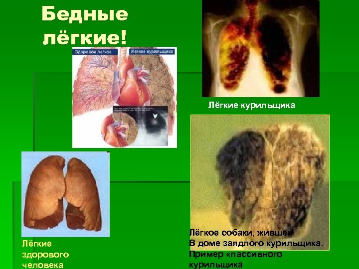 Бедные лёгкие! Лёгкие курильщика Лёгкие здорового человека Лёгкое собаки, жившей В доме заядлого курильщика.
