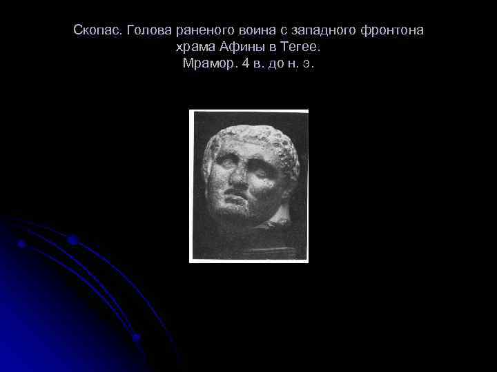 Скопас. Голова раненого воина с западного фронтона храма Афины в Тегее. Мрамор. 4 в.