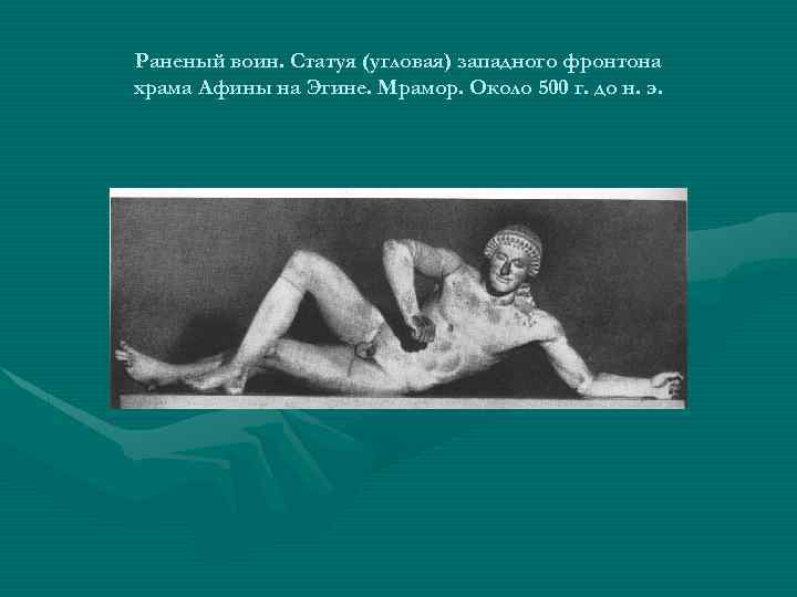 Раненый воин. Статуя (угловая) западного фронтона храма Афины на Эгине. Мрамор. Около 500 г.