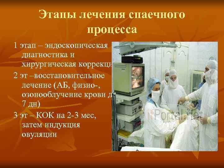 Этапы лечения спаечного процесса 1 этап – эндоскопическая диагностика и хирургическая коррекция 2 эт