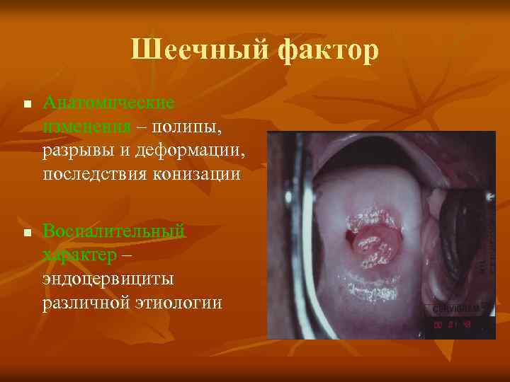 Шеечный фактор n n Анатомические изменения – полипы, разрывы и деформации, последствия конизации Воспалительный