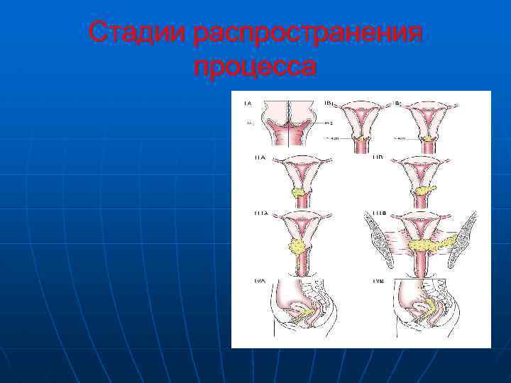 Стадии распространения процесса 