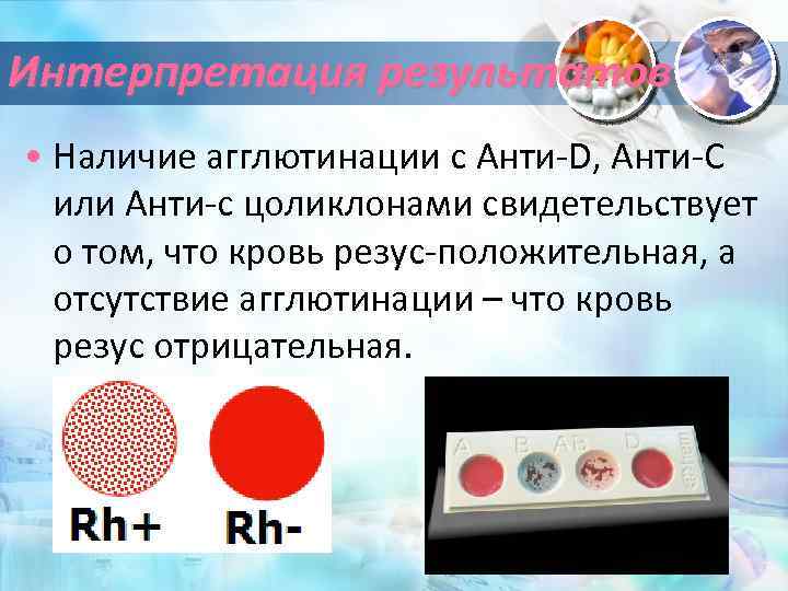 Интерпретация результатов • Наличие агглютинации с Анти-D, Анти-С или Анти-с цоликлонами свидетельствует о том,