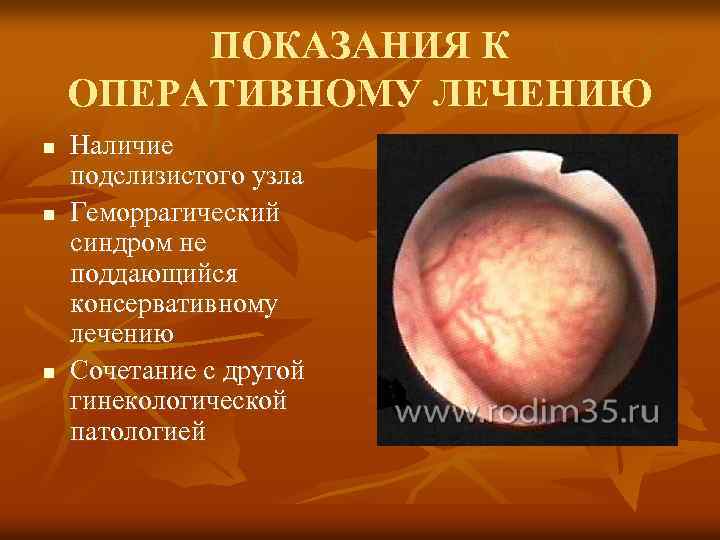 ПОКАЗАНИЯ К ОПЕРАТИВНОМУ ЛЕЧЕНИЮ n n n Наличие подслизистого узла Геморрагический синдром не поддающийся
