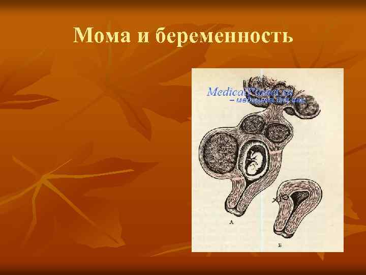 Мома и беременность 