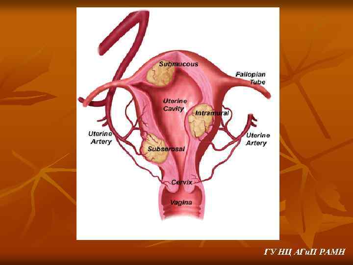 ГУ НЦ АГи. П РАМН 