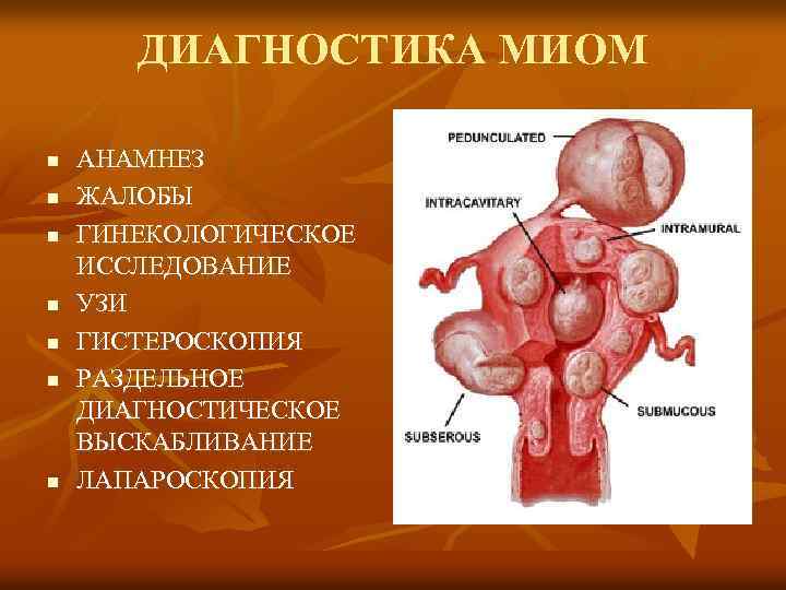 ДИАГНОСТИКА МИОМ n n n n АНАМНЕЗ ЖАЛОБЫ ГИНЕКОЛОГИЧЕСКОЕ ИССЛЕДОВАНИЕ УЗИ ГИСТЕРОСКОПИЯ РАЗДЕЛЬНОЕ ДИАГНОСТИЧЕСКОЕ