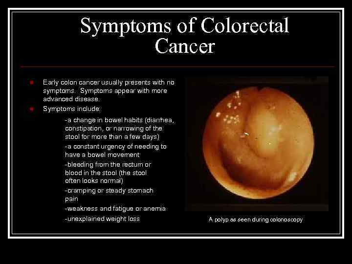 Symptoms of Colorectal Cancer n n Early colon cancer usually presents with no symptoms.