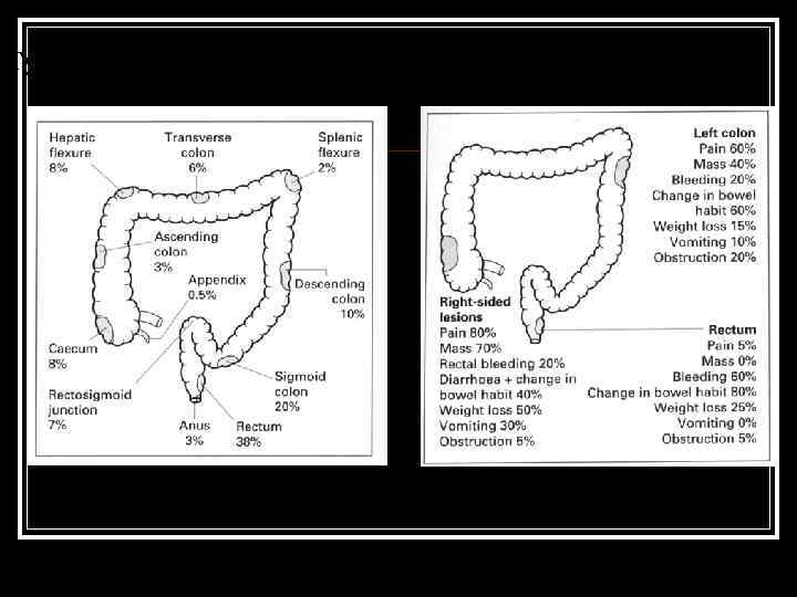 Typical sites of incidence and sympoms of colon cancer 