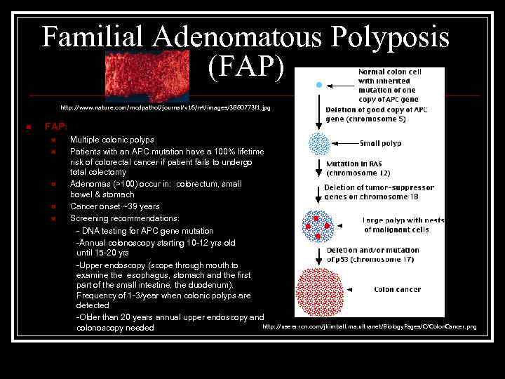 Familial Adenomatous Polyposis (FAP) http: //www. nature. com/modpathol/journal/v 16/n 4/images/3880773 f 1. jpg n