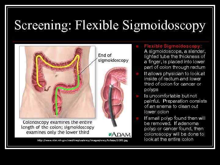 Screening: Flexible Sigmoidoscopy n n http: //www. nlm. nih. gov/medlineplus/ency/images/ency/fullsize/1083. jpg Flexible Sigmoidoscopy: A