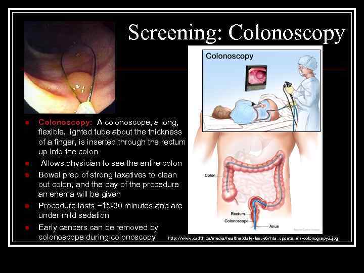 Screening: Colonoscopy n n n Colonoscopy: A colonoscope, a long, flexible, lighted tube about