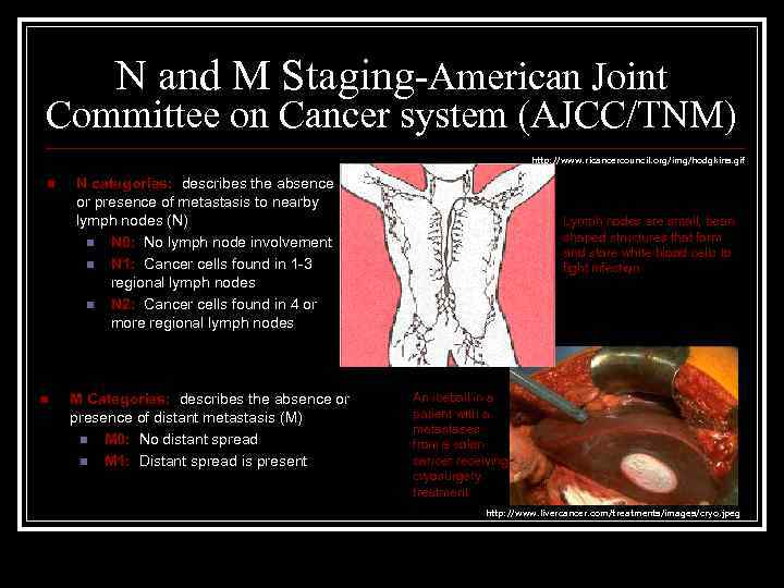 N and M Staging-American Joint Committee on Cancer system (AJCC/TNM) http: //www. ricancercouncil. org/img/hodgkins.