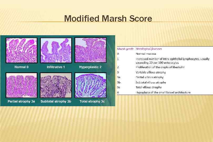 Modified Marsh Score 