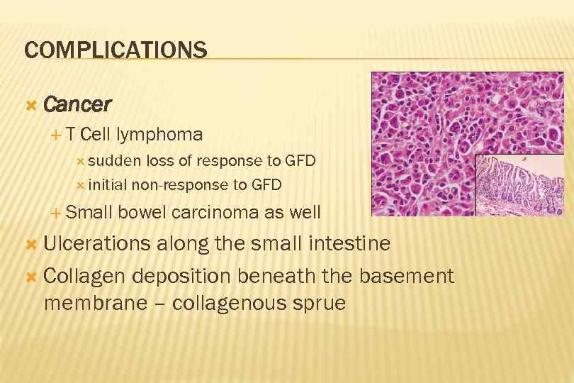 COMPLICATIONS Cancer T Cell lymphoma sudden loss of response to GFD initial non-response to