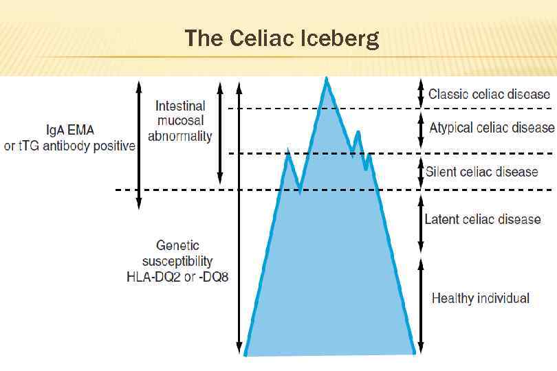 The Celiac Iceberg 