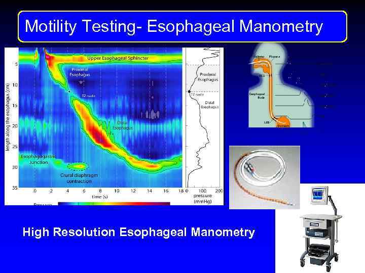 Motility Testng Motility Testing- Esophageal Manometry High Resolution Esophageal Manometry 