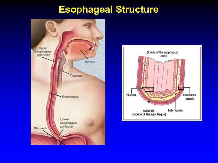 Esophageal Structure 